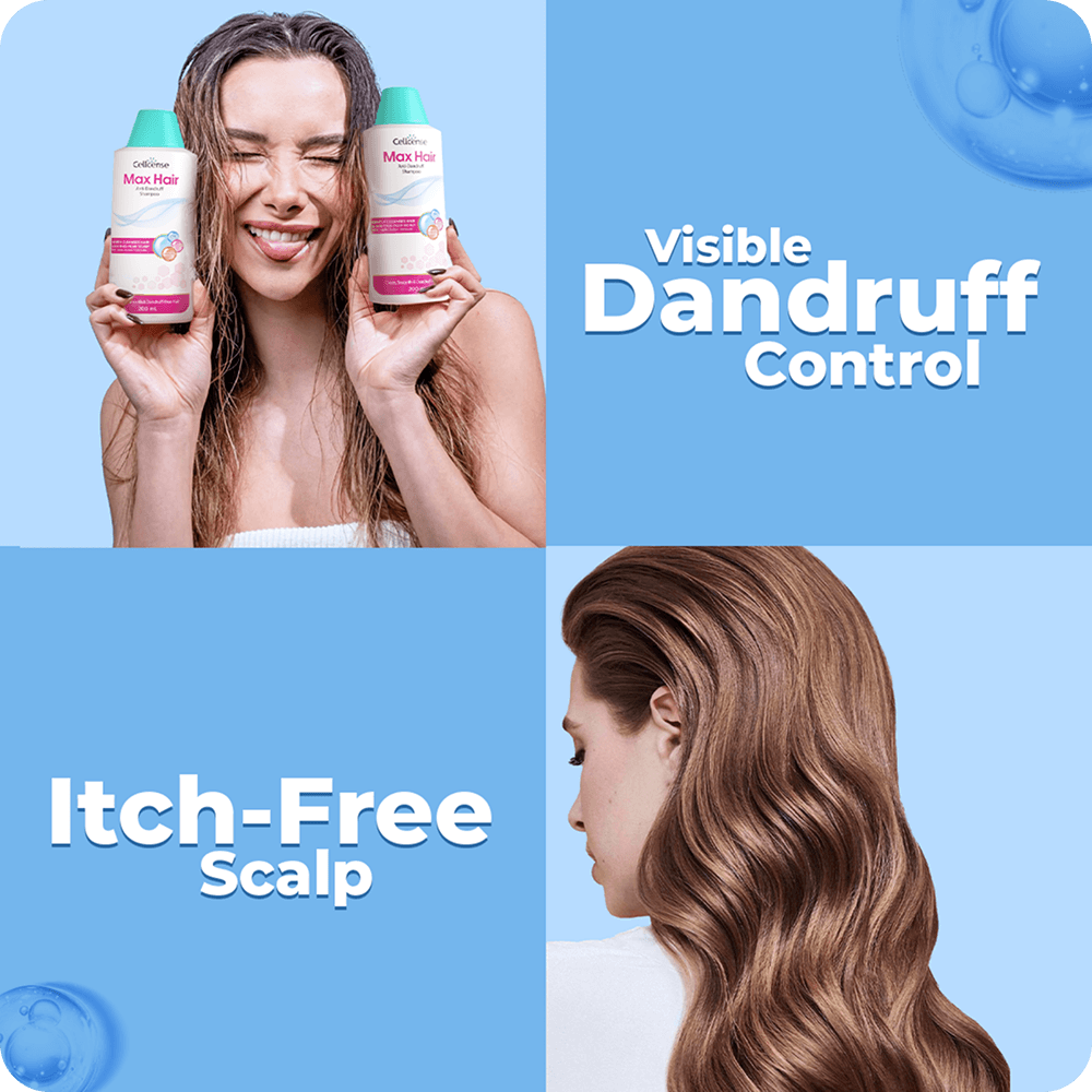 Max Hair Anti-Dandruff Shampoo results
